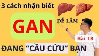 3 CÁCH NHẬN BIẾT GAN ĐANG CẦU CỨU BẠN CỰC HAY | Ds Nguyễn Quốc Tuấn