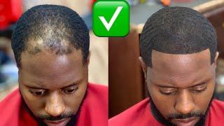 CLEAN HAIRCUT FIX FOR BALDING MEN | HAIR FIBERS