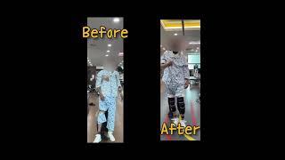 뇌졸중 환자 Before & After
