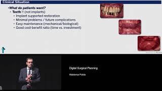 Digital Surgical Planning | Waldemar Polido