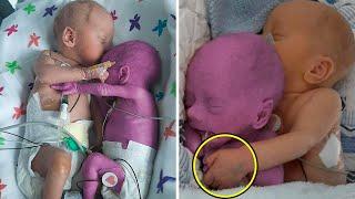 Verpleegster Legt Gezonde Baby naast Zijn Stervende Tweeling, Iedereen is Spraakloos door Wat Volgt