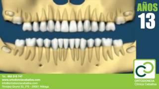 Cambio de la dentición: de dientes de leche a definitivos