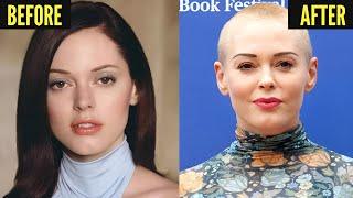 16 Famous Celebrities Who Ruined Their Faces with Plastic Surgery! (Part 2)