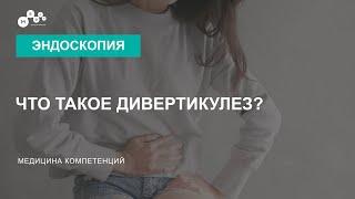 Что такое дивертикулез кишечника?