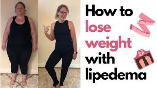 How to Lose Weight With Lipedema