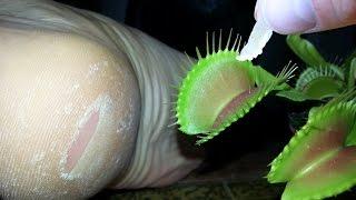 FEEDING HUMAN SKIN TO A VENUS FLYTRAP! An Organic Diet!!