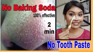 Remove BLACKHEADS / WHITEHEADS at home in just 2 minutes | best & easy | no baking soda