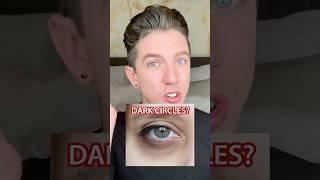 Dark Circles (Best of 2024!)