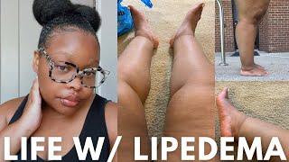 A Day in the Life Living with Lipedema