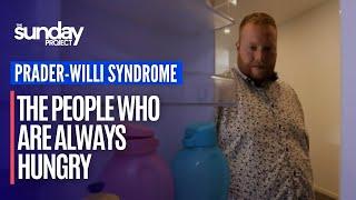 Prader-Willi Syndrome: The Children Who Are Always Hungry