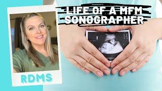 Life of a MFM Sonographer | (Maternal Fetal Medicine + OB/GYN)