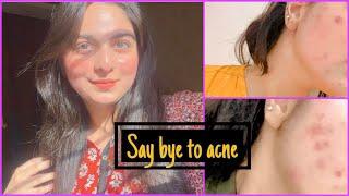 Get rid of acne permanently|best medicated acne treatment at home|why we use tretinoin?