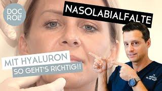 NASOLABIALFALTEN MIT HYALURON ERKLÄRT von Dr. Rolf Bartsch