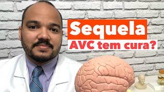 Sequela de AVC é irreversível?