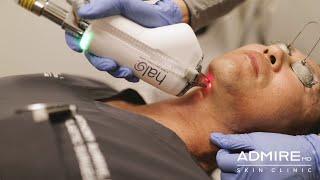 Scottsdale Medspa - Sciton Halo & BBL Treatment