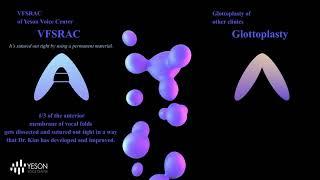 Yeson's VFSRAC Surgery is highly distinguished! How?