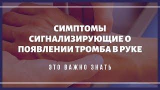 Какие симптомы могут сигнализировать о появлении тромба в руке?