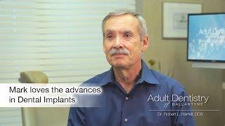 Charlotte NC Dental Implants - Mark's Story