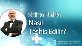 Spina Bifida Nasıl Teşhis Edilir? | Prof. Dr. Hasan Hilmi Muratlı - Ortopedi ve Travmatoloji Uzmanı
