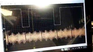 Cam/crank waveform using an Autoscope IV