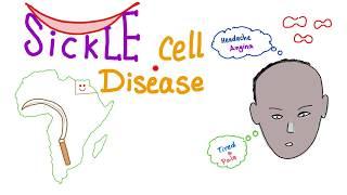 Sickle Cell Disease (SCD) - Sickle Cell Anemia - Quick Review - Hematology Series