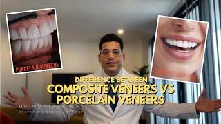 Composite VS Porcelain Veneers - Which is better? Watch this before you make your Decision