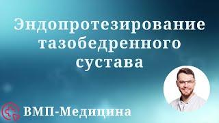 Эндопротезирование тазобедренного сустава | ВМП-Медицина