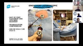 Veterinary Endoscopy Society: Adrenalectomy webinar