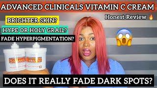  ADVANCED CLINICALS VITAMIN C LOTION HONEST REVIEW | DOES IT REALLY FADE DARK SPOTS?