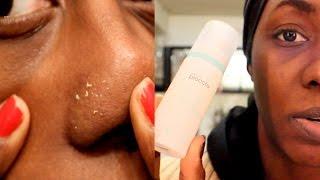 Does Proactiv Really Work??!!