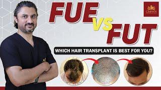 FUE vs FUT Hair Transplant Which is Better For You | FUE vs FUT Results and Cost | Crown