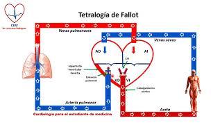 Circuito de la Tetralogia de Fallot