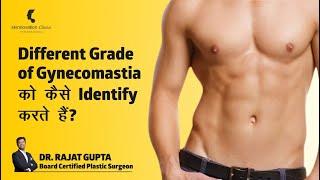 Different Grade of Gynecomastia को कैसे Identify करते हैं? Dr Rajat Gupta - Skinnovation Clinics