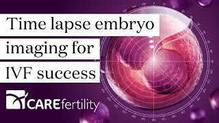 Time lapse embryo imaging for IVF success | Caremaps-AI® | Care Fertility