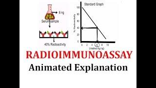 Radioimmunoassay (RIA): Animated explanation