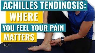 Achilles Tendonitis - Where you Feel your Pain Matters