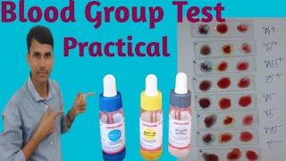 Blood Group Test Practical / ABO Rh(D)