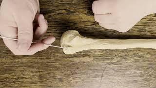 Humerus Oberarmknochen | Anatomie Bewegungsapparat