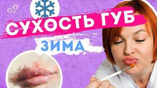 Уход за губами. Сухость губ, заеды, герпес, хейлит - что делать?