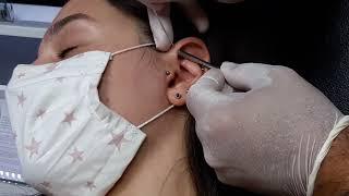 Forward Helix Piercing w/Murat Gürel