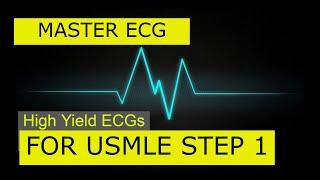 High Yield ECGs for USMLE | Master ECGs FAST (Part 1)
