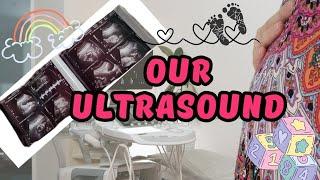 we are exited/rainbow baby/pregnancy after miscarriage/Marilyn & Elvis Aluzimbi Volg