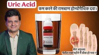 Uric acid कम करने की Homeopathic Medicine ? My Experience | Case Study |