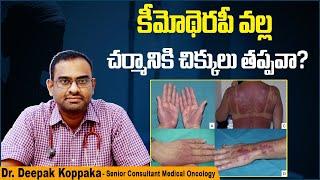 చర్మంపై కీమోథెరపీ ప్రభావాలు || How to Prevent Chemotherapy Extravasation || Kaizen Oncology Network