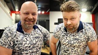 Men's Hair System Before and After | LaVivid Hair