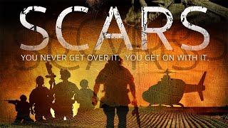 Scars (2023) | FULL DRAMA MOVIE | Allen Williamson | Michael Paré | Eric Roberts | Elizabeth Gast