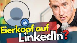 Auch DEIN FEHLER? LinkedIn: Profilbild-Sichtbarkeit