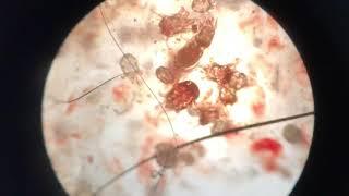 Rabbit Ear Mites Psoroptes cuniculi