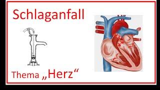 Schlaganfall Thema Herz