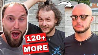 BALDING Men Before/After Going FULL BALD #1